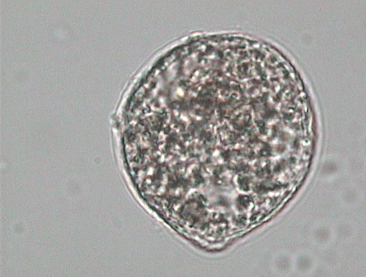 Stemonitis axifera?